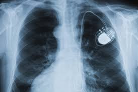 Medical Devices: where is the publicly available evidence?